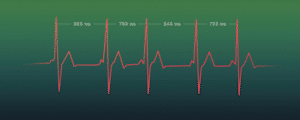 HRV Mapping